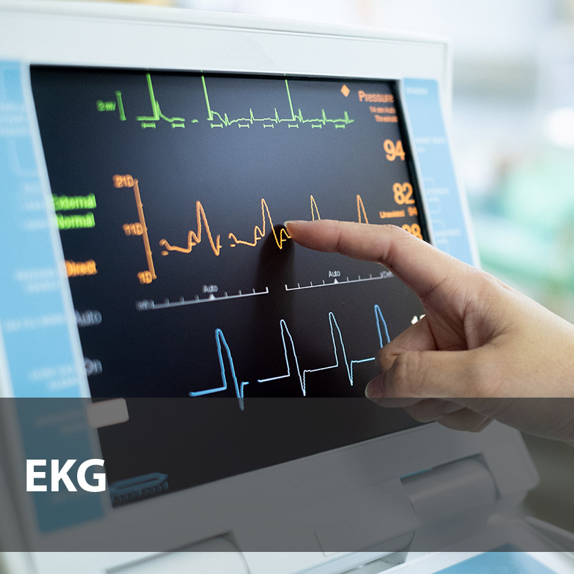 EKG